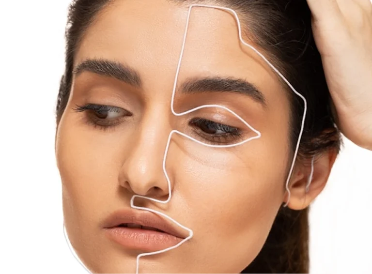 Estiramiento facial 2 días - 14 horas